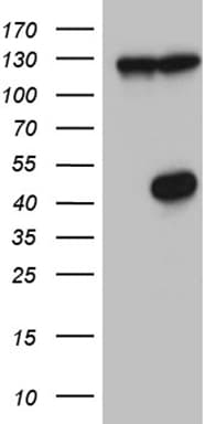 Monoclonal Mouse anti-Human HDAC8 Antibody (clone OTI9H8, aa1-243, WB)