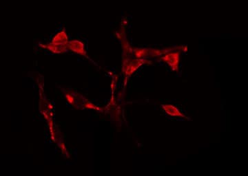 CDCA7 Antibody