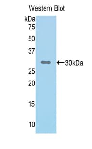 CFI / Complement Factor I Antibody (aa340-583, Biotin)