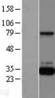 QPRT Protein (Over-Expression Lysate Myc-DDK (Flag))