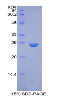 Rat F9 / Factor IX Protein (Recombinant His)