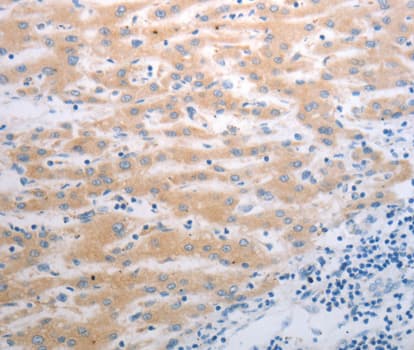 Polyclonal Rabbit anti-Human PAK1 Antibody (IHC, WB)