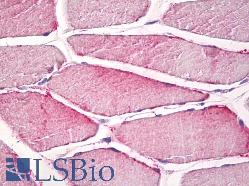 IHC-plus™ Monoclonal Mouse anti-Human CPNE6 / N-COPINE Antibody (clone 6.4_1B4, IHC, WB)