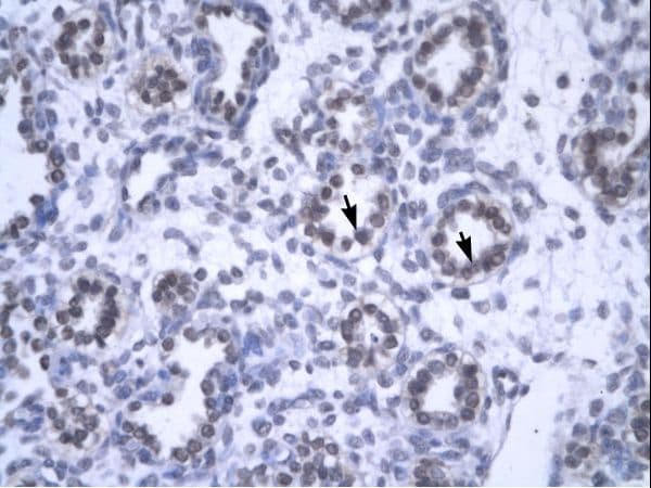 GAS41 Antibody (aa158-207)