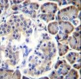 SMAP2 Antibody (aa111-140)
