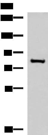 Polyclonal Rabbit anti-Human NPHP1 / Nephronophthisis Antibody (IHC, WB)