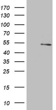 NARS2 Antibody (clone OTI8D10)