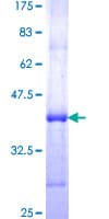 Human MYOF / Myoferlin Protein (Recombinant GST, N-terminus)