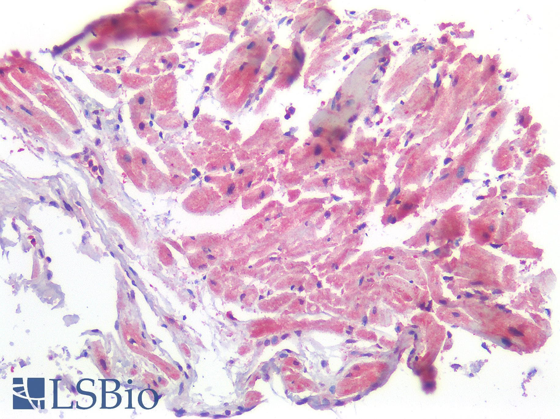 IHC-plus™ ROR1 Antibody (Internal Region)