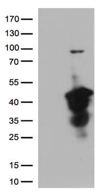 CTSL / Cathepsin L Antibody (aa114-333, clone OTI2C10)