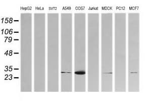 KLK8 / Kallikrein 8 Antibody (clone OTI2C6)