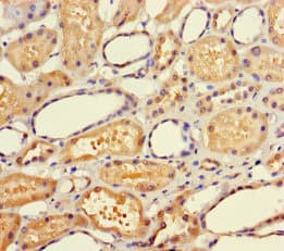 ATAD3C Antibody