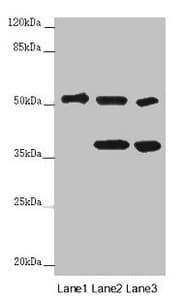 Polyclonal Rabbit anti-Human PPP2R2D Antibody (IHC, IF, WB)