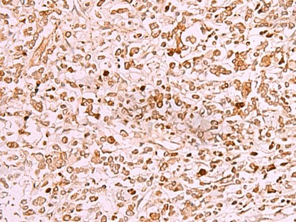 SAMSN1 Antibody