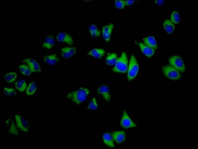 SGCB / SGC / Sarcoglycan Beta Antibody