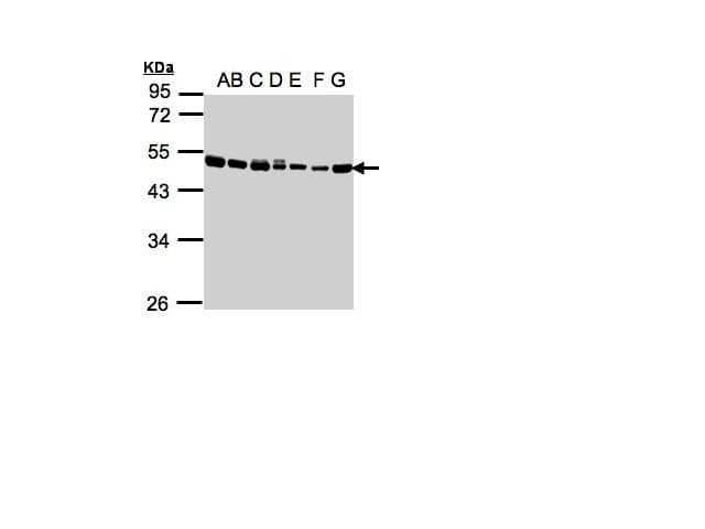 IHC-plus™ EEF1A2 Antibody
