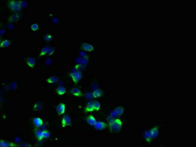 EBP Antibody (aa2-230)