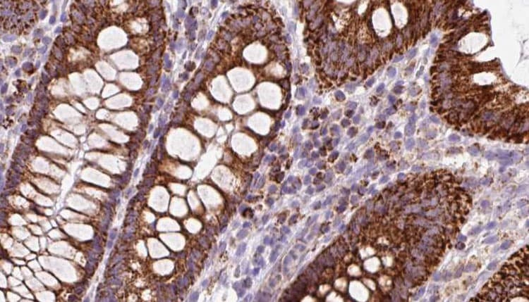 OSBP Antibody