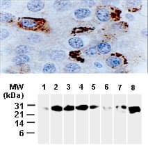 IHC-plus™ Polyclonal Rabbit anti-Human BCL2L1 / BCL-XL Antibody (aa46-66, IHC, WB)