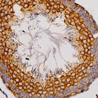 ADORA2A/Adenosine A2A Receptor Antibody (C-Terminus)
