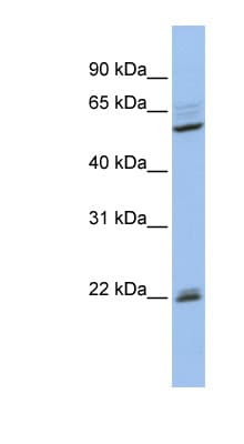 NR0B1 / DAX1 Antibody (aa359-408)