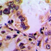 Polyclonal Rabbit anti-Human PABPC5 Antibody (Internal, IHC, WB)