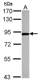 Polyclonal Rabbit anti-Human TARS Antibody (IHC, WB)