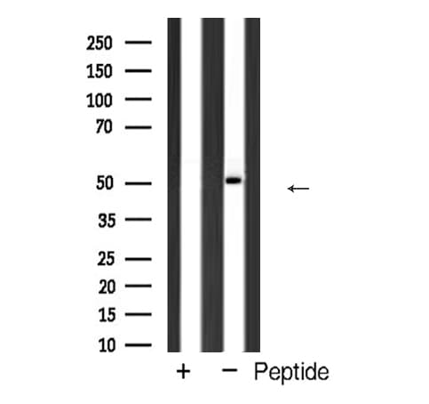 Polyclonal Rabbit anti-Human HNRNPK / hnRNP K Antibody (IF, WB)