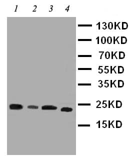 Polyclonal Rabbit anti-Mouse PEBP1 / RKIP Antibody (aa15-29, IHC, WB)