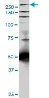 IHC-plus™ Monoclonal Mouse anti-Human TLN1 / Talin 1 Antibody (clone 5C1, IHC, WB)