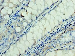 RSPO1 / RSPO Antibody (aa21-263)