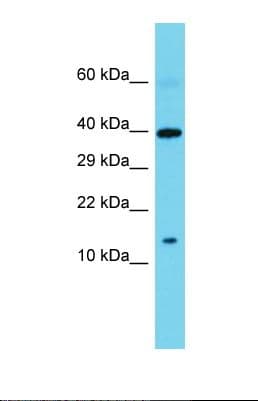 SPAG11B Antibody (aa15-64)