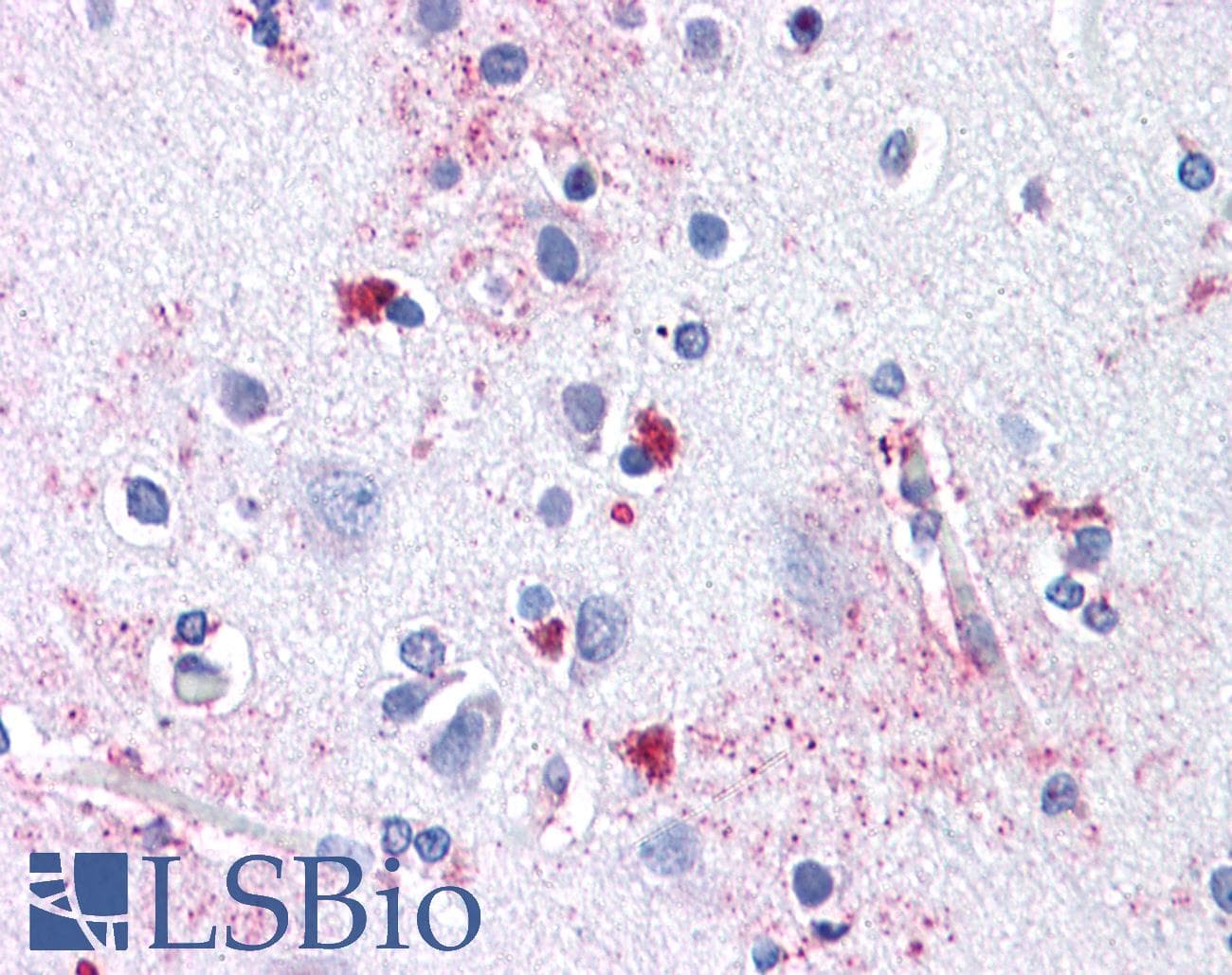IHC-plus™ Polyclonal Rabbit anti-Human SLC29A1 / ENT1 Antibody (Internal, IHC)