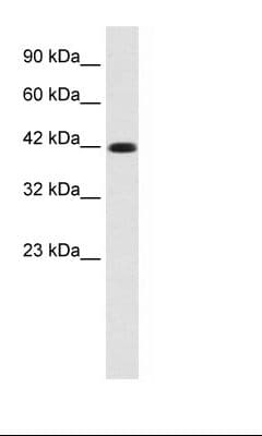 Polyclonal Rabbit anti-Human KCNQ2 Antibody (aa189-238, IHC, WB)