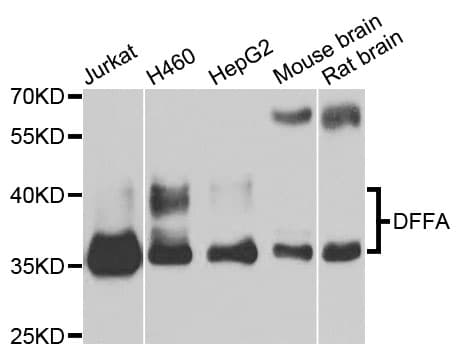 DFFA / ICAD / DFF45 Antibody