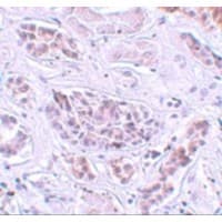 Polyclonal Rabbit anti-Human ATG3 Antibody (IHC, IF, WB)