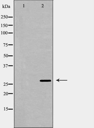 PSME1 Antibody