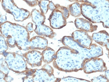 TIMP2 Antibody (clone TIMP2/2044)
