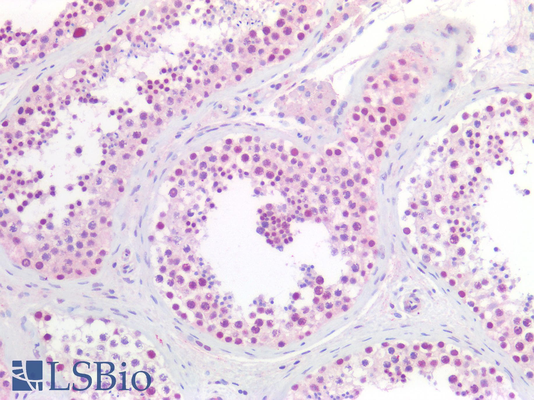 PathPlus™ CCNL2 / Cyclin L2 Antibody