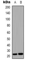 FGF9 Antibody (C-Terminus)
