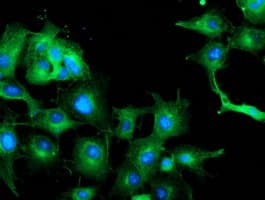 TUBAL3 Antibody (aa150-446, clone OTI1G6, Carrier-free)