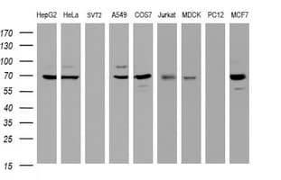 GLB1 / Beta-Galactosidase Antibody (clone OTI1C9)