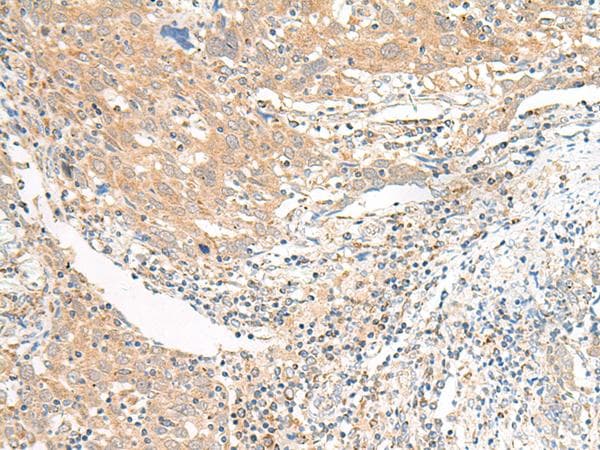 SLC6A9 / GLYT1 Antibody