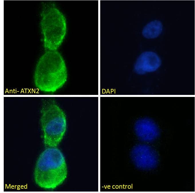 ATXN2 / SCA2 / Ataxin-2 Antibody (aa479-489)