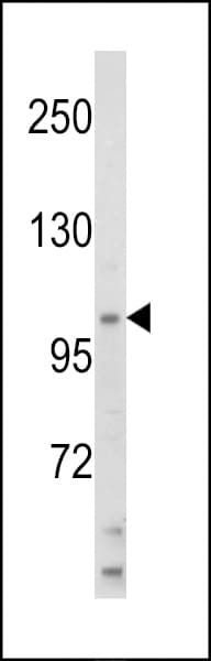 SMARCA3 / HLTF Antibody (aa409-437)