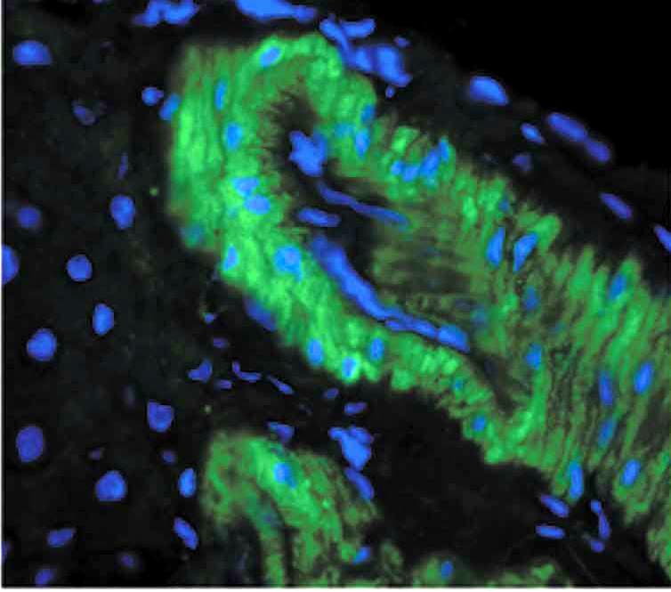 Nitrotyrosine Antibody (clone 39B6, APC)