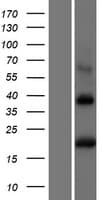 Human BST2 Protein (Over-Expression Lysate Myc-DDK (Flag))