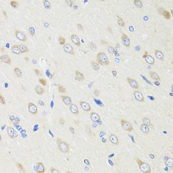 Polyclonal Rabbit anti-Human CRABP2 Antibody (IHC, IF, WB)