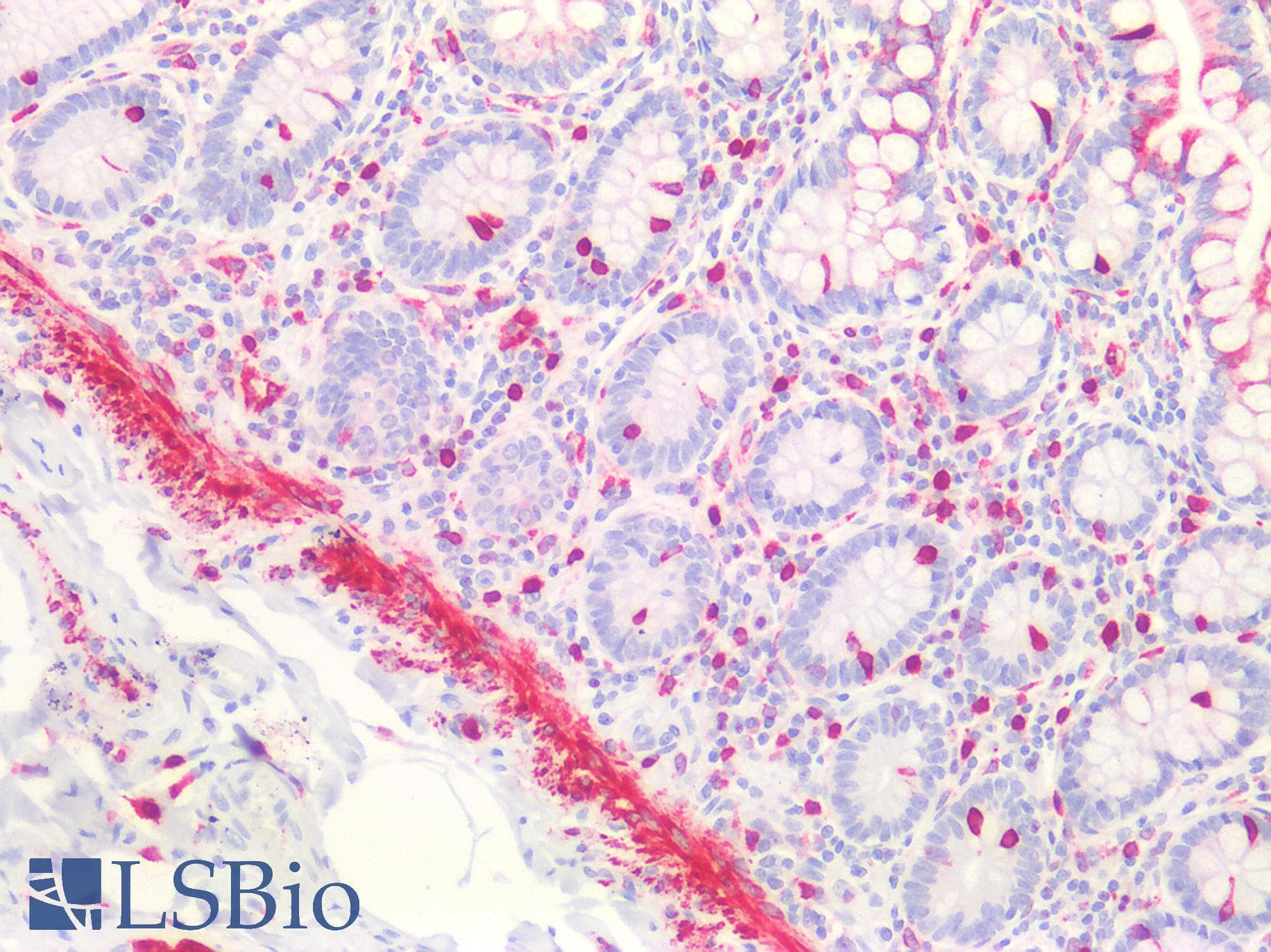 IHC-plus™ Polyclonal Rabbit anti-Human PTGS1 / COX-1 Antibody (C-Terminus, IHC, WB)