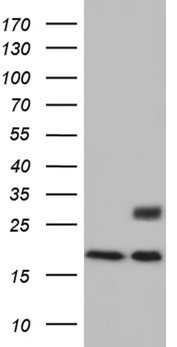 Adiponectin Antibody (aa19-244, clone OTI7H8)